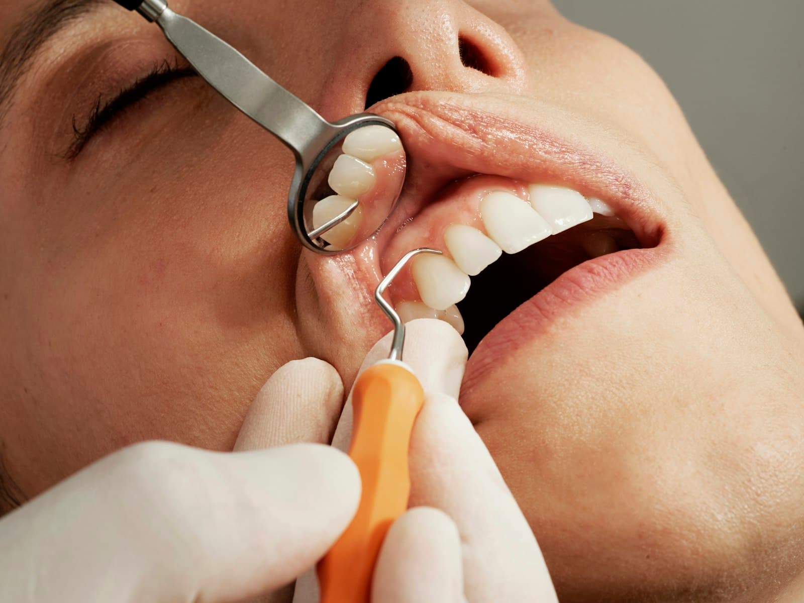 Close-up of a dental examination using a mirror and a gentle probe