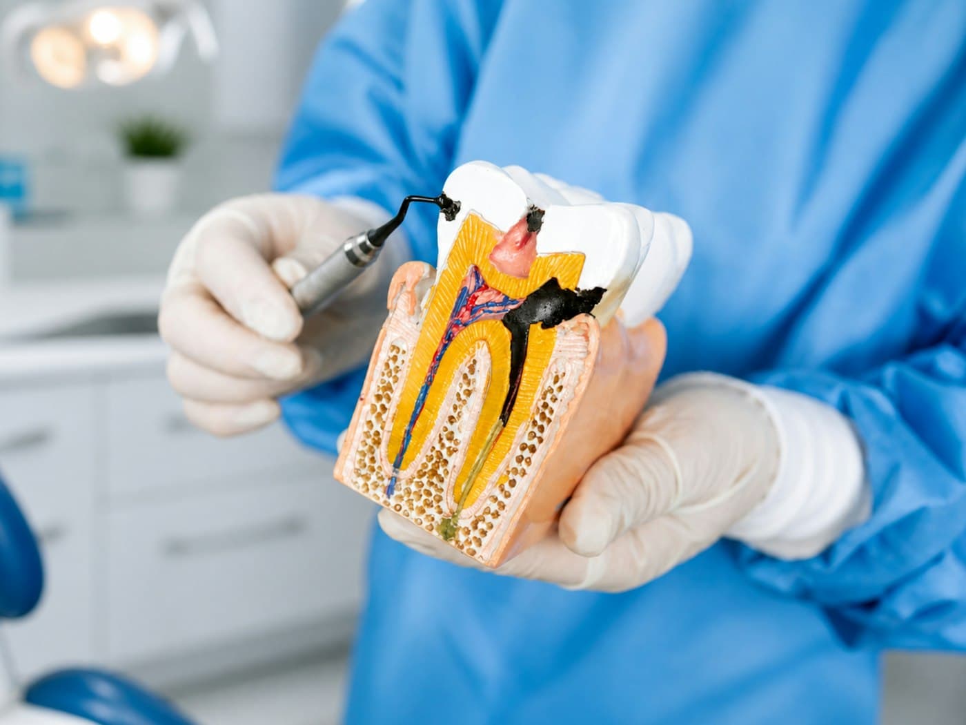 A dental professional in blue scrubs holding a cross-section model of a tooth to explain treatment